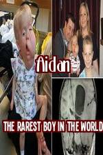 Watch Aidan The Rarest Boy In The World Megavideo