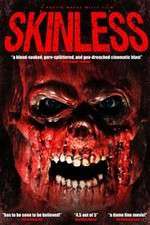 Watch Skinless Megavideo