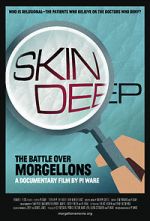 Watch Skin Deep: The Battle Over Morgellons Megavideo