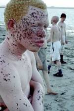 Watch Albino United Megavideo
