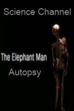 Watch Science Channel Elephant Man Autopsy Megavideo