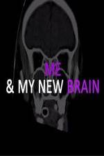 Watch Me & My New Brain Megavideo