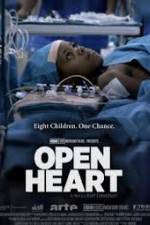 Watch Open Heart Megavideo