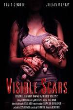 Watch Visible Scars Megavideo