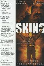 Watch Skins Megavideo