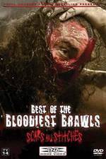 Watch TNA Wrestling: Best of the Bloodiest Brawls - Scars and Stitches Megavideo