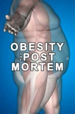 Watch Obesity: The Post Mortem Megavideo