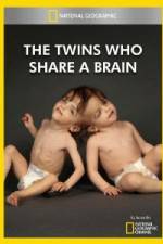 Watch National Geographic The Twins Who Share A Brain Megavideo