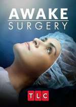 Watch Awake Surgery Megavideo