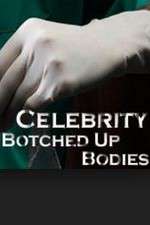 Watch Celebrity Botched Up Bodies Megavideo